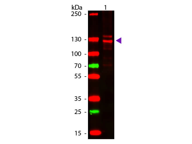 Human Collagen Type I