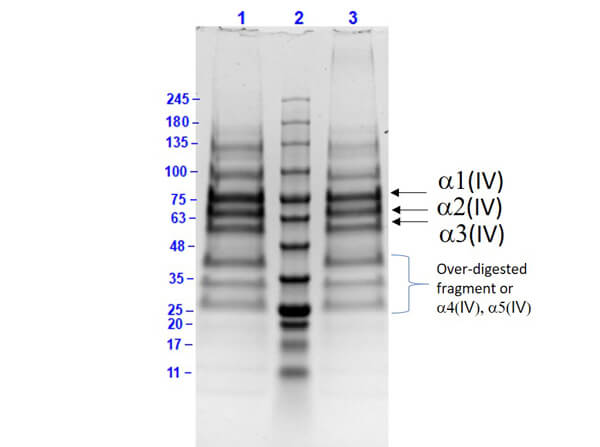 Human Collagen Type IV