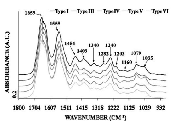 Human Collagen Type VI