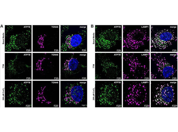 Immunofluorescence using Transferin Rhodamine Immunofluorescence using Transferin Rhodamine