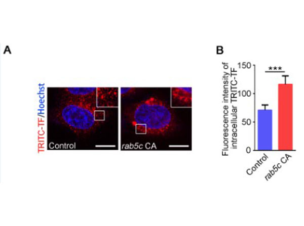Immunofluorescence using Transferin Rhodamine Immunofluorescence using Transferin Rhodamine