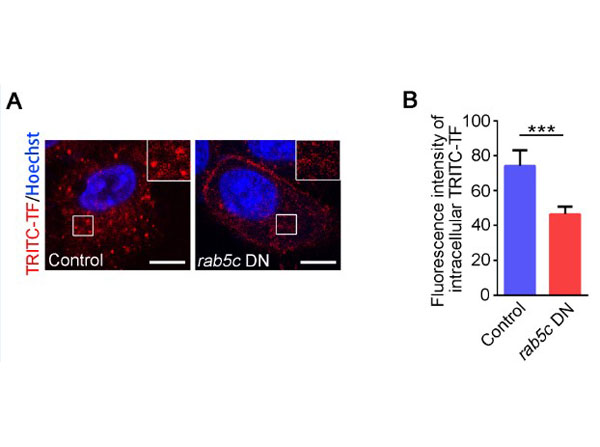 Immunofluorescence using Transferin Rhodamine Immunofluorescence using Transferin Rhodamine