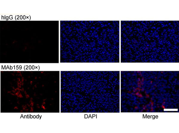 Immunofluorescence using Human IgG Immunofluorescence using Human IgG