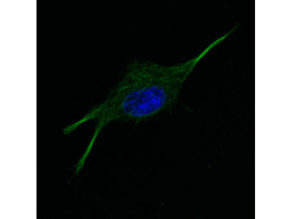 Immunofluorescence microscopy of Anti-tubulin Immunofluorescence microscopy of Anti-tubulin