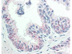AKT pS473 Monoclonal Antibody – Immunohistochemistry AKT pS473 Monoclonal Antibody – Immunohistochemistry