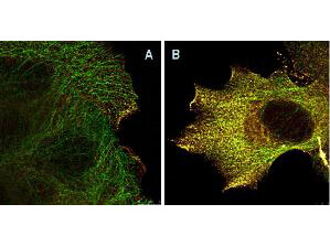 AKTpS473 Antibody - STED Nanoscopy AKTpS473 Antibody - STED Nanoscopy