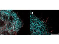 AKT pS473 Monoclonal Antibody - Immunofluorescence Microscopy AKT pS473 Monoclonal Antibody - Immunofluorescence Microscopy