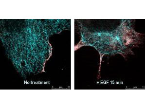 Anti-AKT pS473 Antibody - Confocal Microscopy Anti-AKT pS473 Antibody - Confocal Microscopy