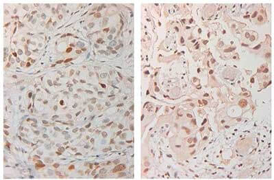 Anti-ATM Monoclonal Antibody-Immunohistochemistry Anti-ATM Monoclonal Antibody-Immunohistochemistry