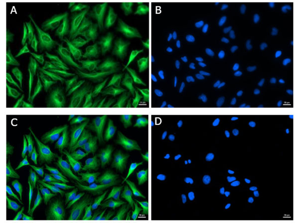 Immunofluorescence of Mouse Anti-Alpha Tubulin Antibody Immunofluorescence of Mouse Anti-Alpha Tubulin Antibody