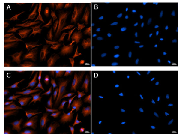 Immunofluorescence of Mouse Anti-Alpha Tubulin Antibody Immunofluorescence of Mouse Anti-Alpha Tubulin Antibody