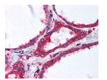 Anti-alpha-Tubulin Monoclonal Antibody - Immunohistochemistry Anti-alpha-Tubulin Monoclonal Antibody - Immunohistochemistry
