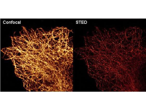 Anti-alpha-Tubulin Monoclonal Antibody - Immunofluorescence Microscopy Anti-alpha-Tubulin Monoclonal Antibody - Immunofluorescence Microscopy