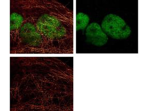 Immunofluorescence Microscopy - alpha-Tubulin Monoclonal Antibody - Immunofluorescence Microscopy - alpha-Tubulin Monoclonal Antibody -