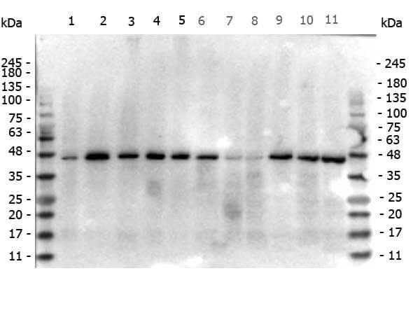 Mouse anti-beta Actin Mouse anti-beta Actin