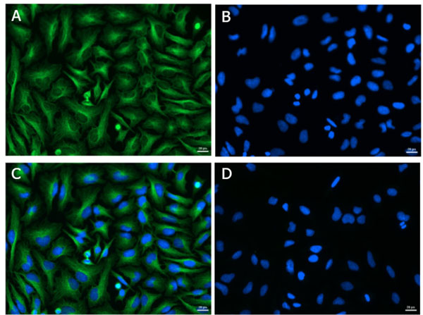 Immunofluorescence of Rabbit Anti-Alpha Tubulin Antibody Immunofluorescence of Rabbit Anti-Alpha Tubulin Antibody