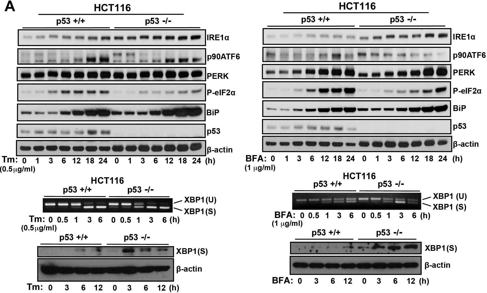 Western Blot using Mouse TrueBlot® ULTRA: Anti-Mouse Ig HRP Western Blot using Mouse TrueBlot® ULTRA: Anti-Mouse Ig HRP
