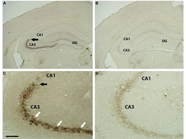 Immunohistochemistry using Mouse Brain Tissue Immunohistochemistry using Mouse Brain Tissue