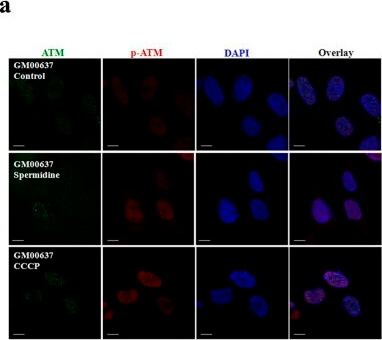 Immunocytochemistry of Anti-ATM pS1981 Immunocytochemistry of Anti-ATM pS1981