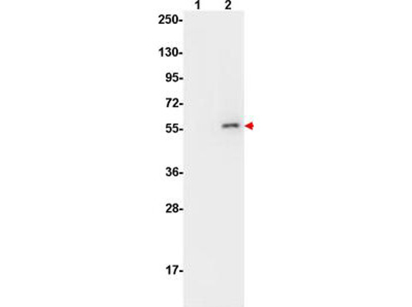Western Blot using Femtomax Western Blot using Femtomax