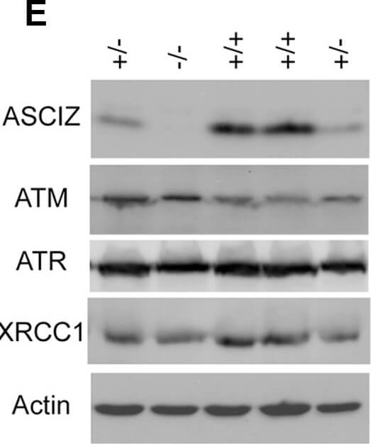 Immunostaining of Anti-ATM pS1981 Immunostaining of Anti-ATM pS1981