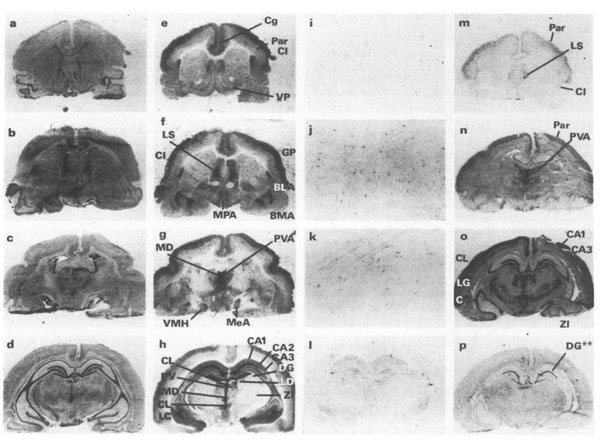 Immunohistochemistry using Guinea Pig Brains Immunohistochemistry using Guinea Pig Brains