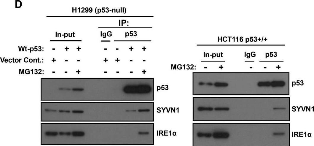 Western Blot using Mouse TrueBlot® ULTRA: Anti-Mouse Ig HRP Western Blot using Mouse TrueBlot® ULTRA: Anti-Mouse Ig HRP