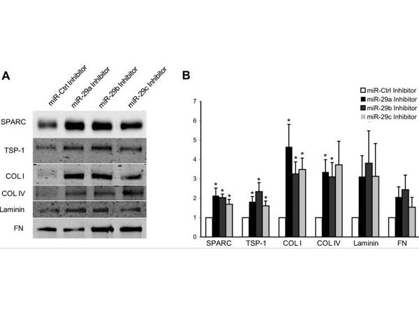Western Blot using TBST Western Blot using TBST