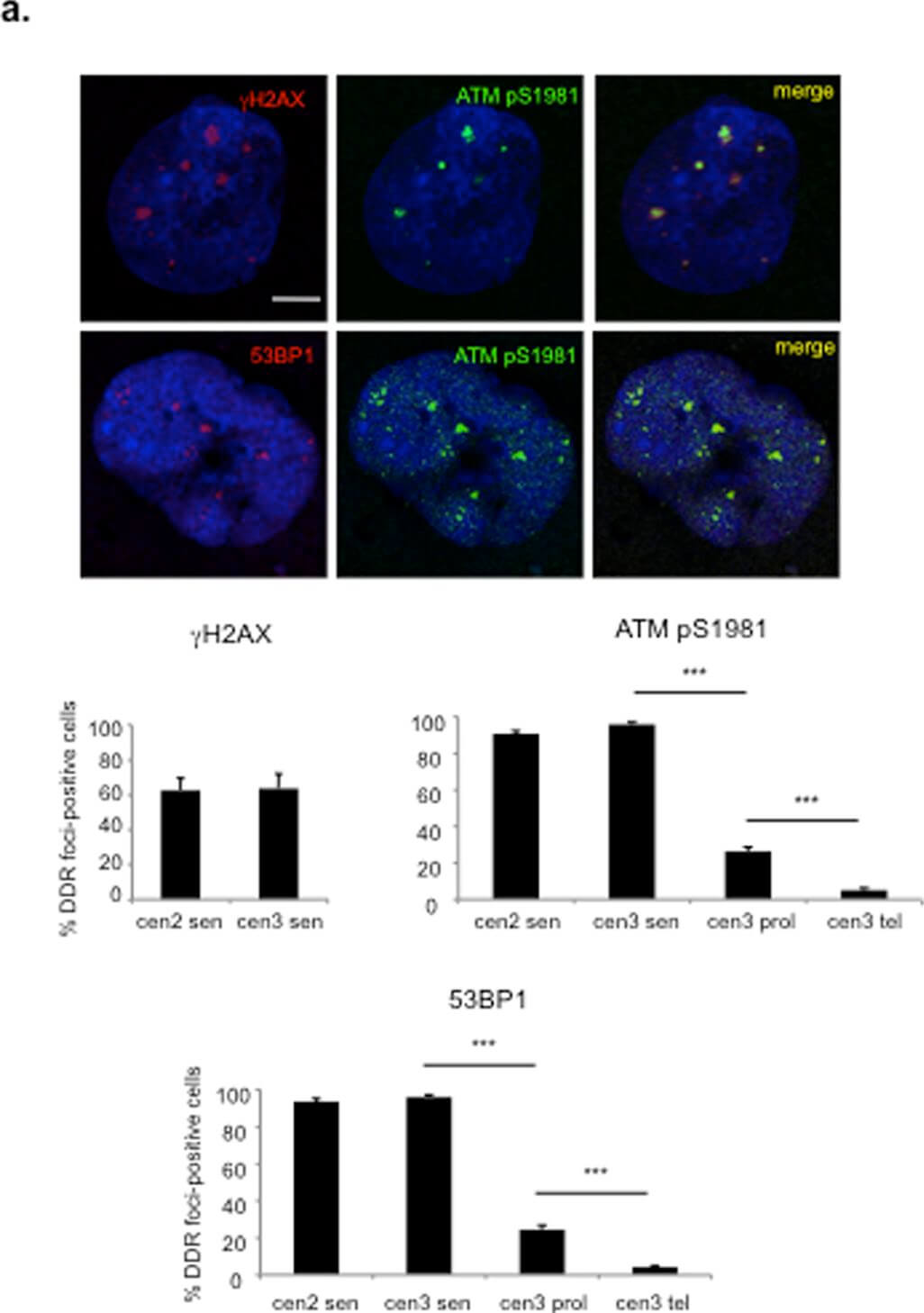 Immunocytochemistry of Anti-ATM pS1981 Immunocytochemistry of Anti-ATM pS1981