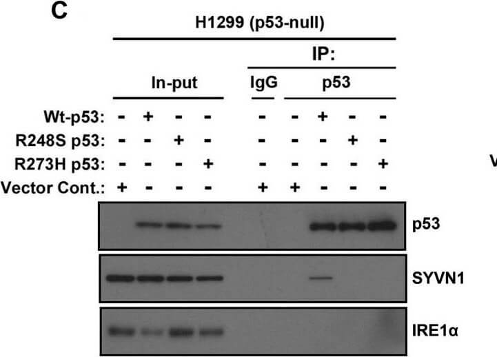 Western Blot using Mouse TrueBlot® ULTRA: Anti-Mouse Ig HRP Western Blot using Mouse TrueBlot® ULTRA: Anti-Mouse Ig HRP