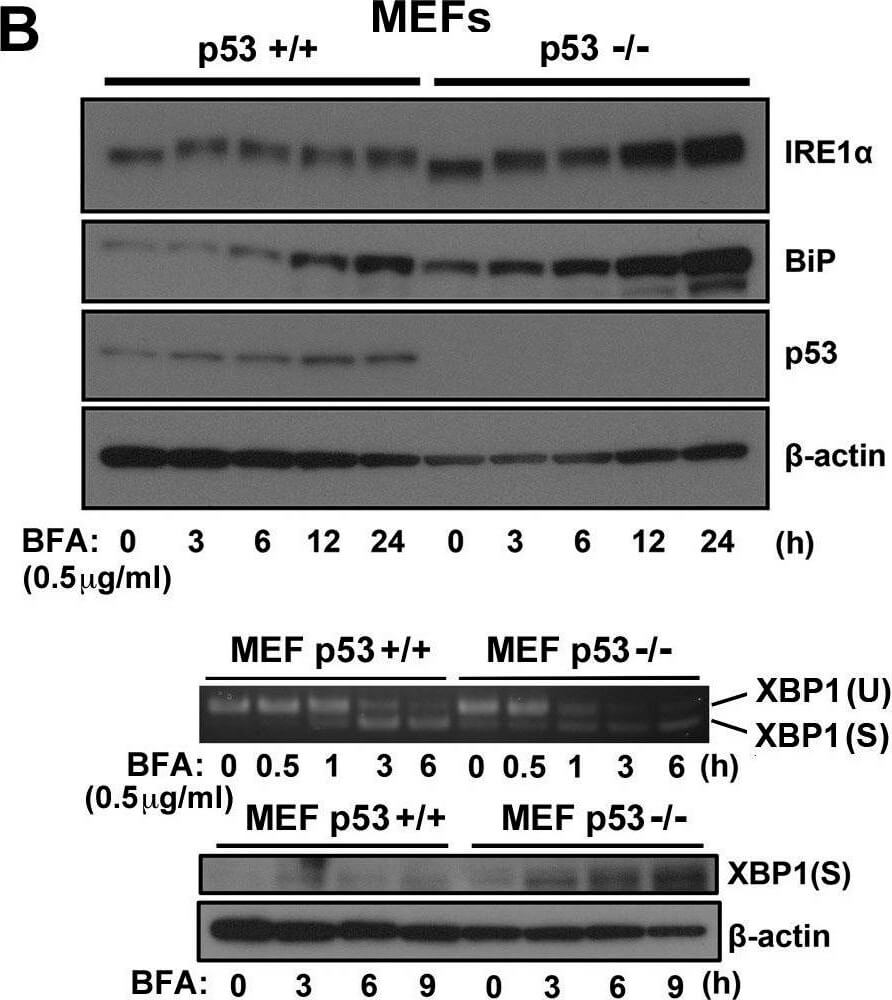 Western Blot using Mouse TrueBlot® ULTRA: Anti-Mouse Ig HRP Western Blot using Mouse TrueBlot® ULTRA: Anti-Mouse Ig HRP