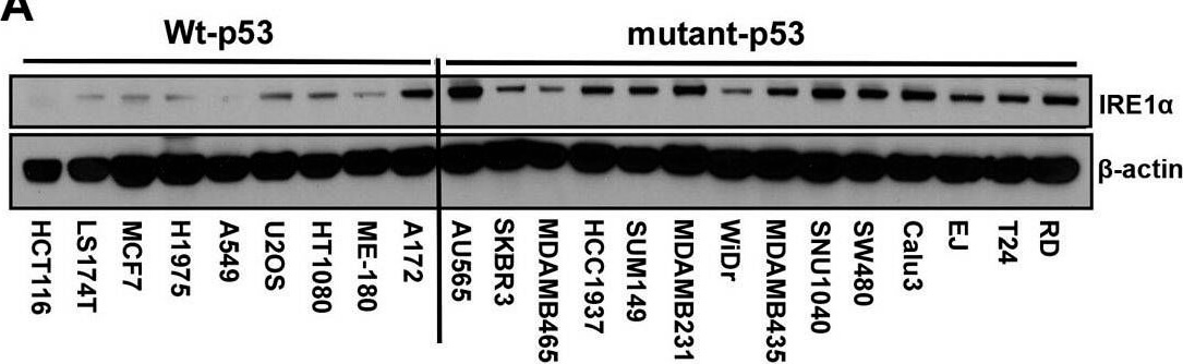 Western Blot using Mouse TrueBlot® ULTRA: Anti-Mouse Ig HRP Western Blot using Mouse TrueBlot® ULTRA: Anti-Mouse Ig HRP