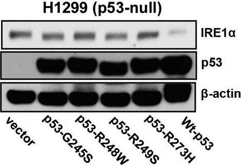 Western Blot using Mouse TrueBlot® ULTRA: Anti-Mouse Ig HRP Western Blot using Mouse TrueBlot® ULTRA: Anti-Mouse Ig HRP