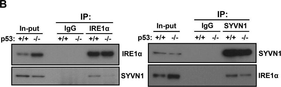 Western Blot using Mouse TrueBlot® ULTRA: Anti-Mouse Ig HRP Western Blot using Mouse TrueBlot® ULTRA: Anti-Mouse Ig HRP